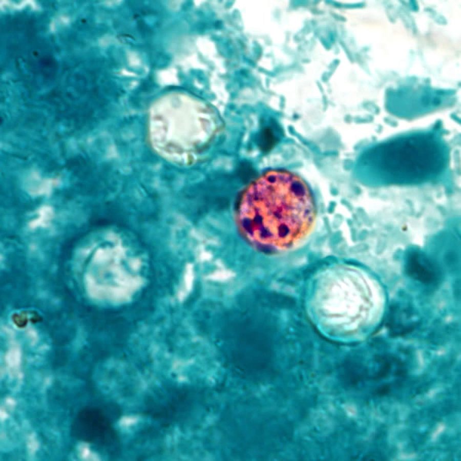 Michigan Officials Link Cyclosporiasis Outbreak to Lettuce or Salad Greens